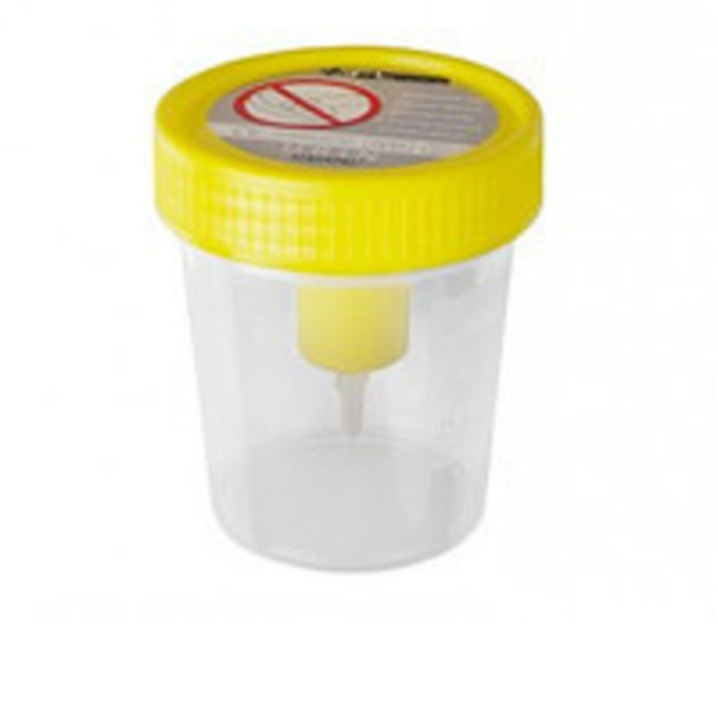 Ємкість для збору сечі Urintransfer 120мл, стерильна (в індивідуальній упаковці)